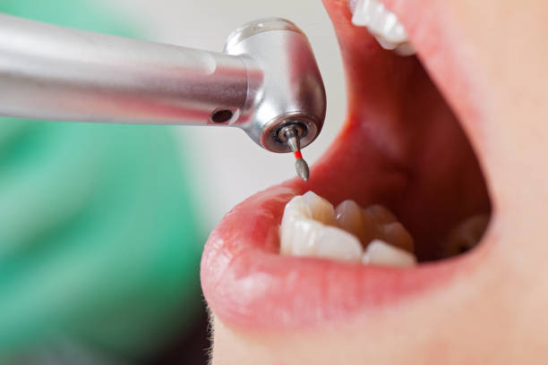 Trusted CA Emergency Dental Service Experts